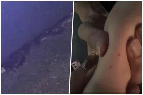 女童母亲说，咬伤女儿的是无毒的网纹蟒，并呼吁家长提高警惕，学会冷静应对。（取自网络）