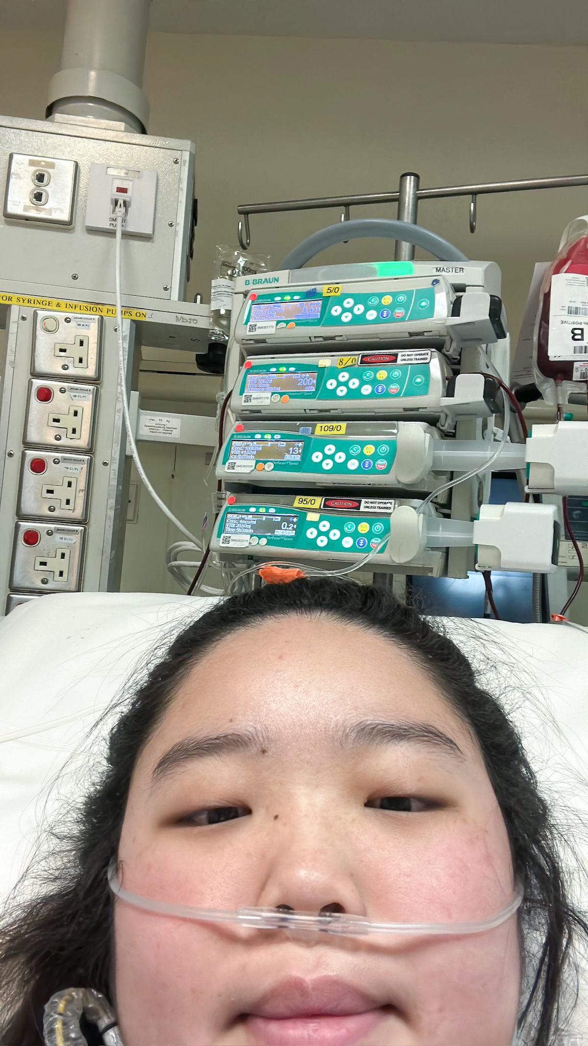 赖佳敏持续高烧入院,病情恶化并出现心脏衰竭,但因不适合使用镇静药物,医疗团队为她实施清醒ECMO治疗。(受访者提供)