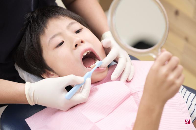 孩子一岁开始就应该定期让牙医检查口腔健康。（iStock图片）