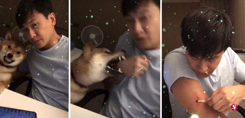 王建复前晚在直播中突然遭到爱犬攻击，右手臂受伤。（取自IG）