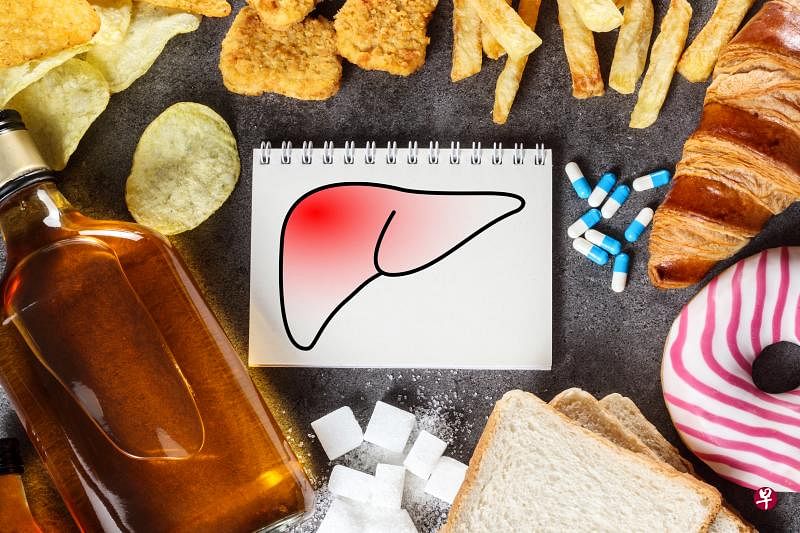 饮食失当导致“三高”和酗酒等，是患上脂肪肝的导因。（iStock图片）