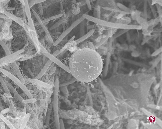 国大杨潞龄医学院微生物学和免疫学系的研究团队发现，对肠道有益的芽囊原虫亚型4，能改变肠道菌群的组成结构，有利于菌群共生。（国大杨潞龄医学院提供）
