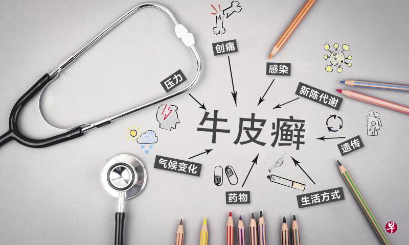 牛皮癣可能是基因、环境因素所造成，或两者皆有。（iStock图片）
