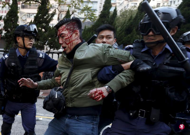 一名身份不明的男子头部受伤，被警方带走。（路透社）