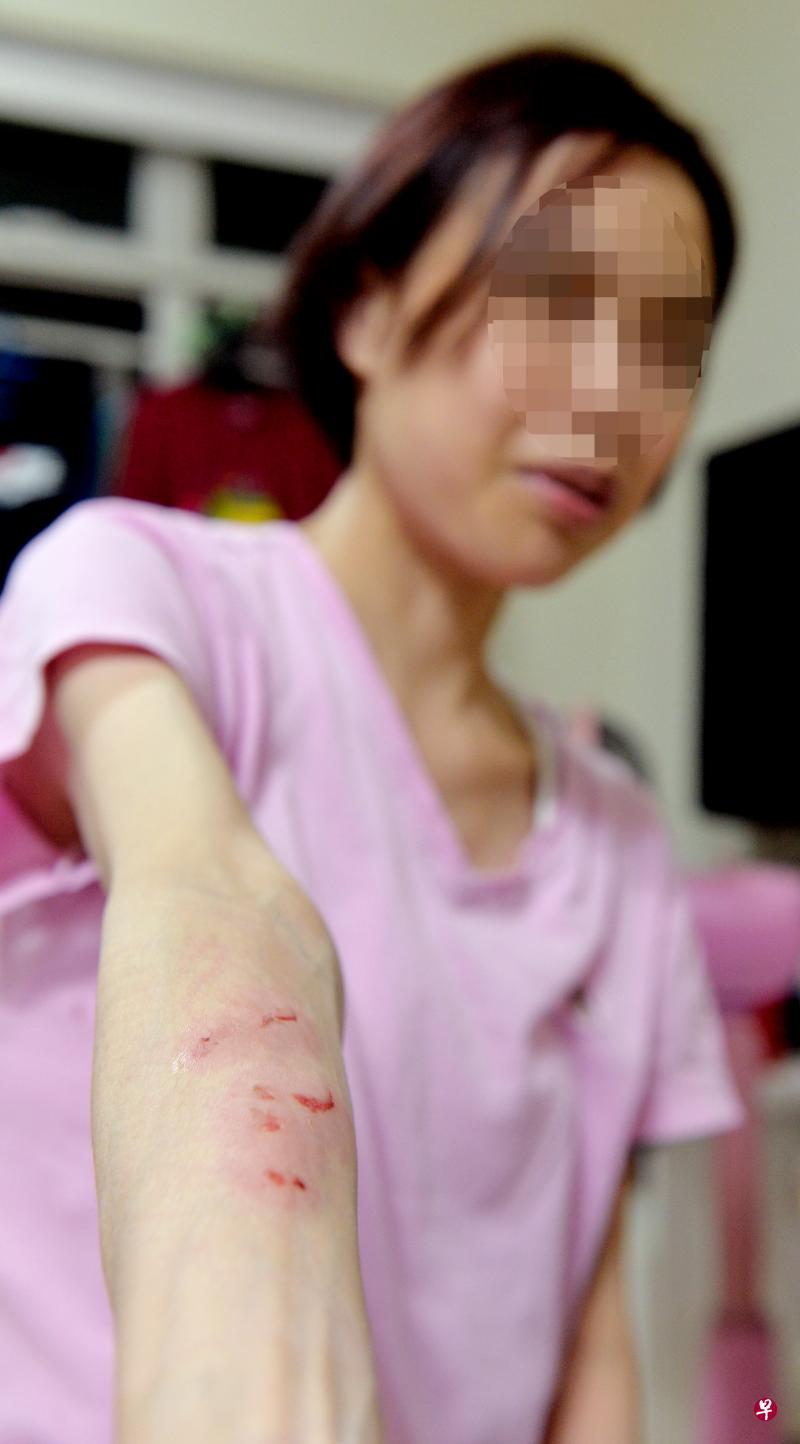 少妇的手臂上出现四条血痕。