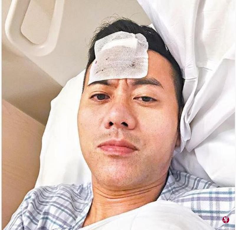 梁汉文昨日凌晨在社交网贴睡在病床照，原来他跌倒撞伤头。（图：网络）