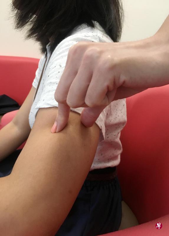 被告用指甲捏伤女佣。（示意图）