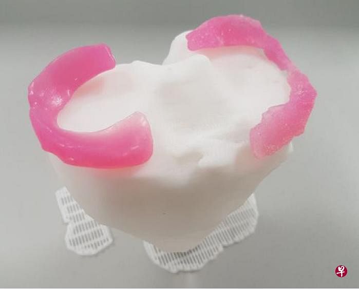 实体大小的3D打印膝盖模型。