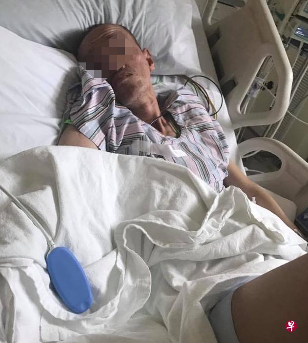 伤者李清平头颅骨裂脑出血，入住重护病房26天，至今日常起居仍无法自理。（档案照）  