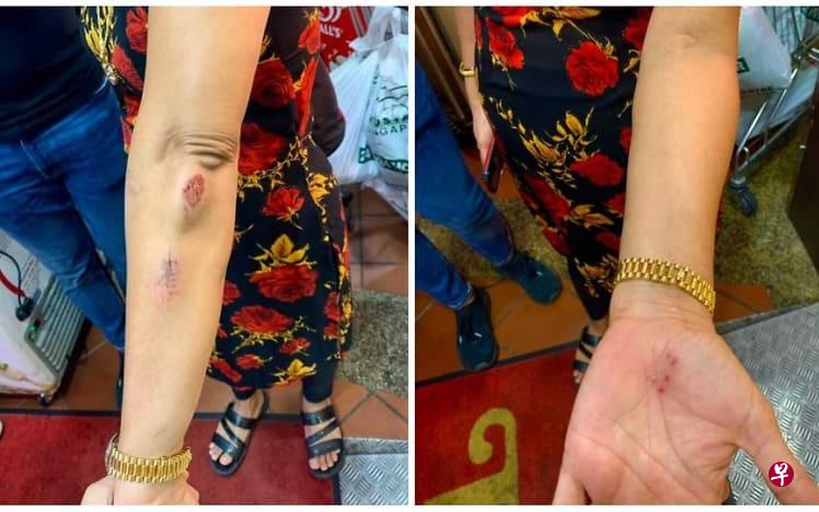 妮塔的女儿事后拍下母亲的伤势，过后在网上贴文公开此事。（档案照） 