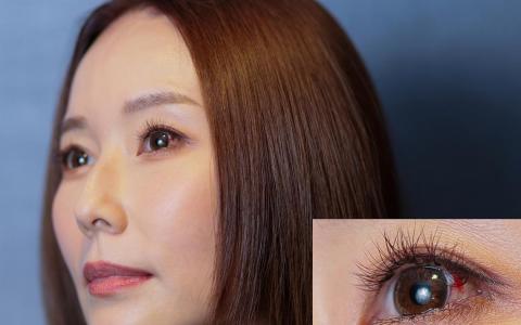 林湘萍左眼爆血管，眼睛布满红丝，她自嘲可以演吸血鬼。（龙国雄摄）