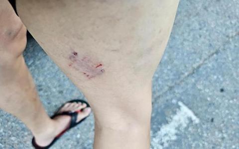 捕捉伤人野狗方式惹议 当局:用捕捉杆符合标准