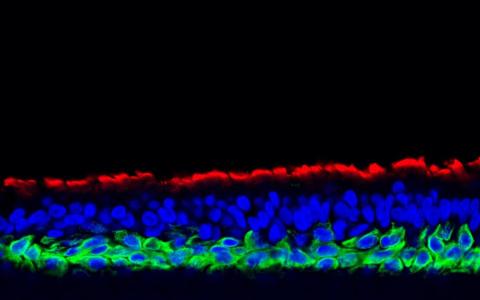 培育“迷你鼻子” 美新科学家研究基因与病毒感染风险