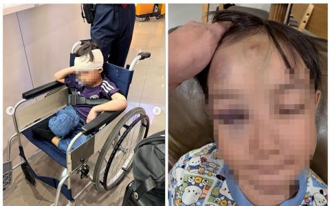 狮城男童韩国机场被撞 眼眶骨折脑震荡 目击者:看到男童跑向轻型电动车