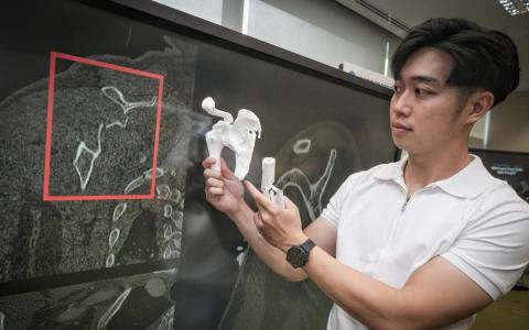陈笃生医院的放射师赵元佑受访时介绍，通过参与“医疗人才加速平台”项目，团队对放射师的工作内容进行了重新构想与设计。他希望未来能将3D和4D打印技术纳入工作范围，直接向患者直观展示其骨骼状况，而不再仅仅依赖传统的X光片。（曾坤顺摄）